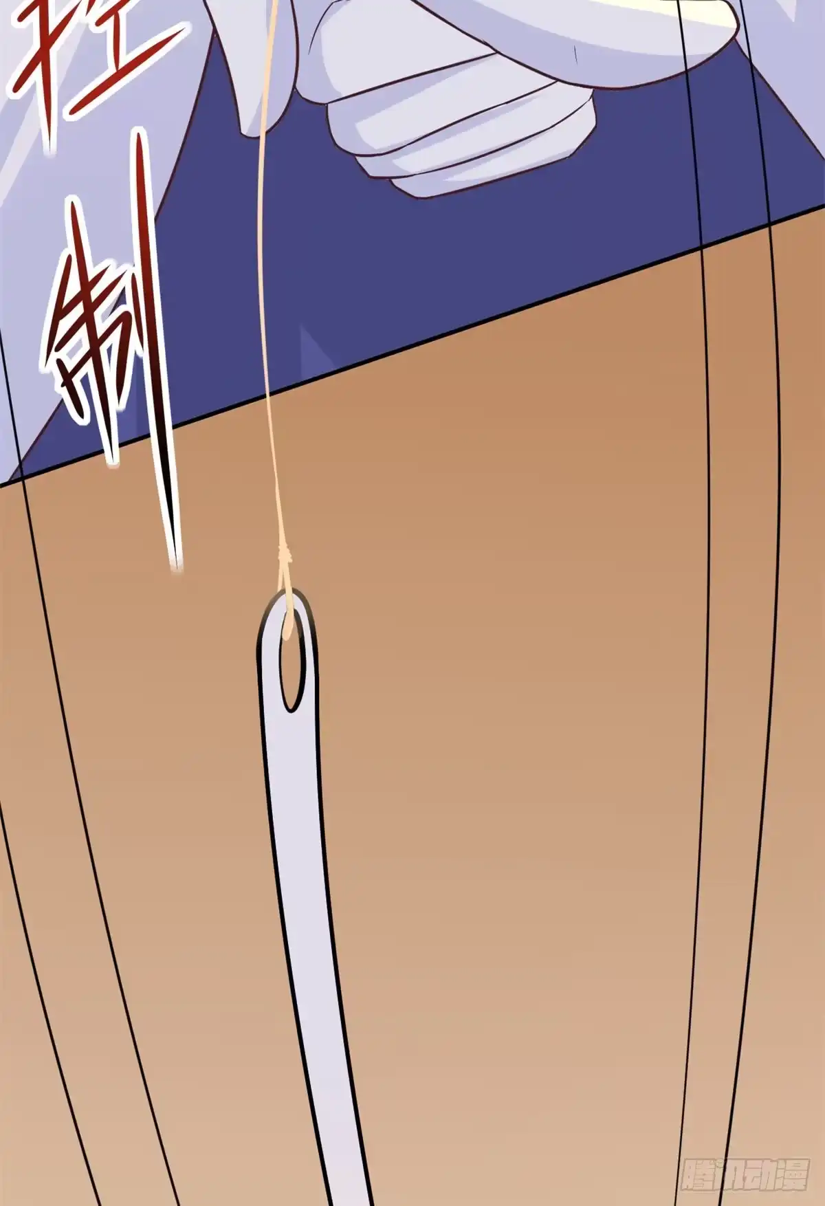 《当医生开了外挂》04 肌腱缝合手术 第4页