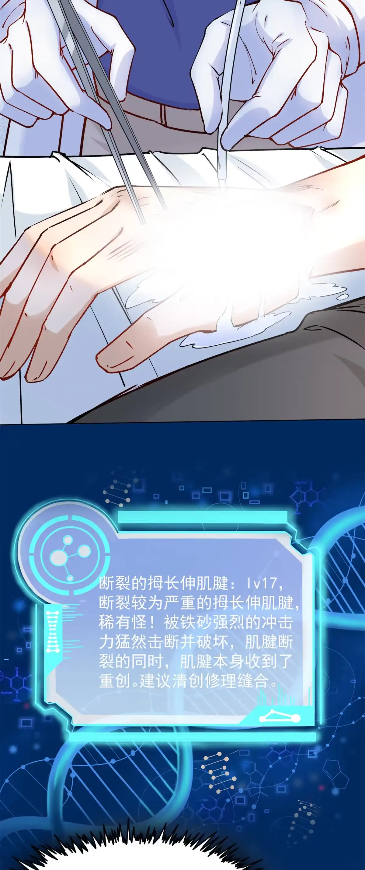 《当医生开了外挂》04 肌腱缝合手术 第97页