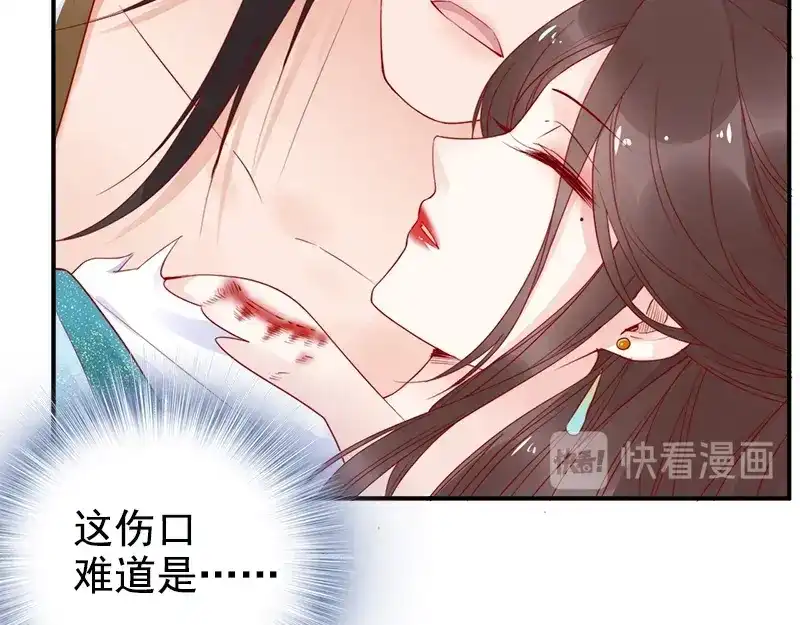 《帝宫东凰飞》第20话 我不抛下你 第77页
