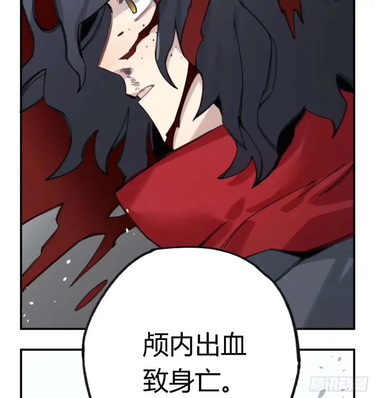 黑白有常 颅内出血 第43页