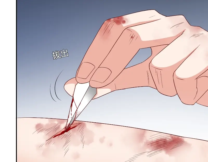美女大小姐的僵尸高手 第79话 针灸 第31页