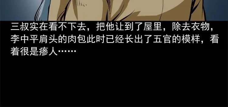 《三老爷诡事会》李中平的怪病 第73页