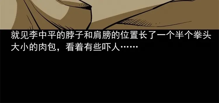 《三老爷诡事会》李中平的怪病 第15页