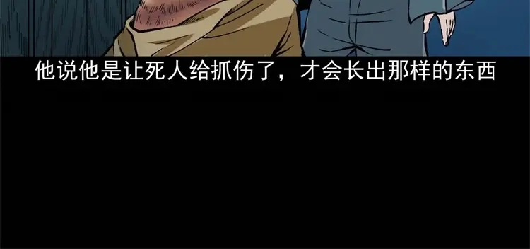 《三老爷诡事会》李中平的怪病 第79页