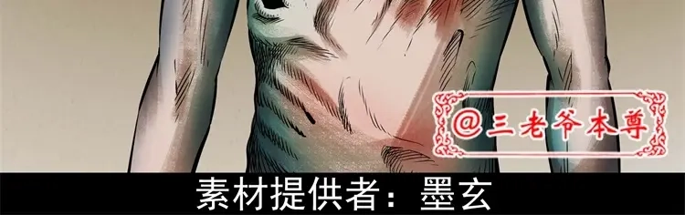 《三老爷诡事会》李中平的怪病 第3页