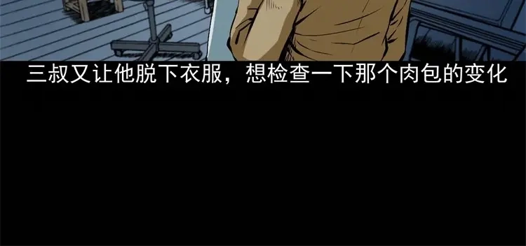 《三老爷诡事会》李中平的怪病 第33页