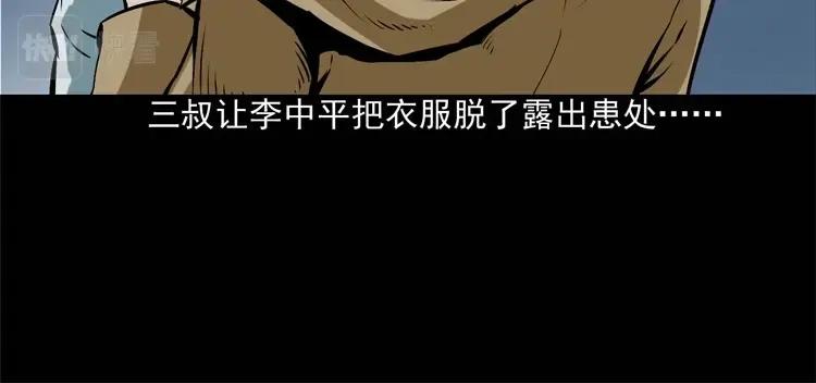 《三老爷诡事会》李中平的怪病 第11页