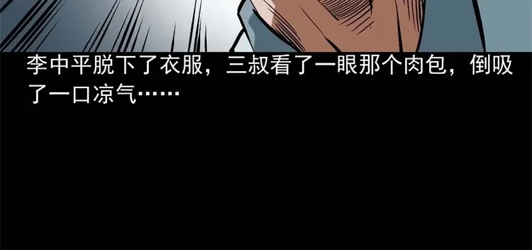 《三老爷诡事会》李中平的怪病 第35页
