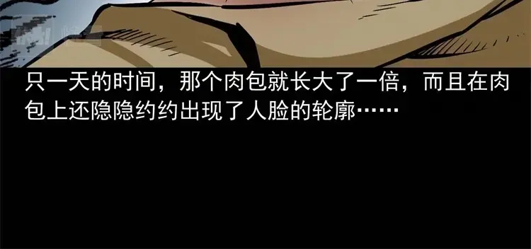 《三老爷诡事会》李中平的怪病 第37页