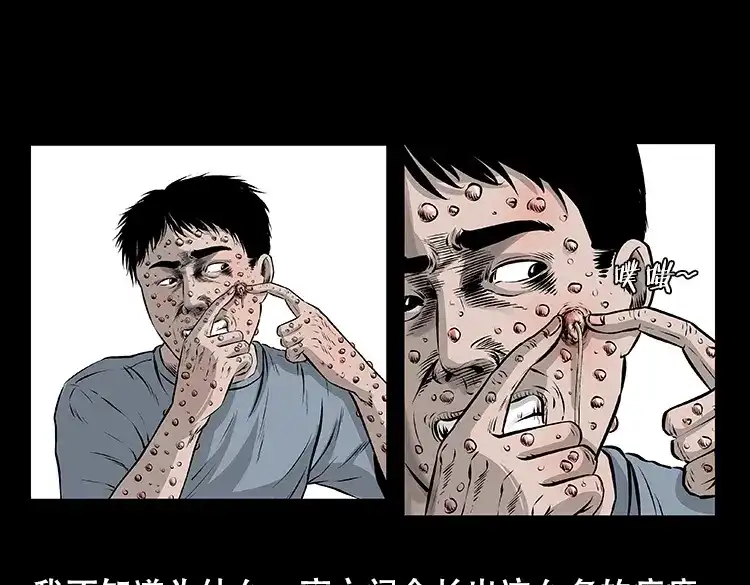 《三老爷诡事会》怪病 第36页