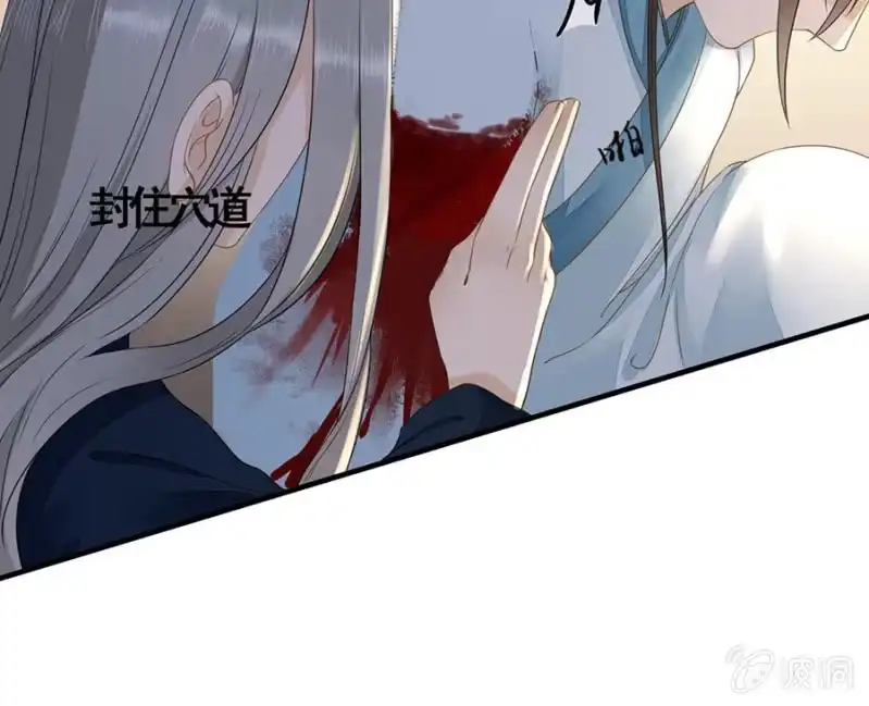 《王的宠妃》第116话 断臂 第27页