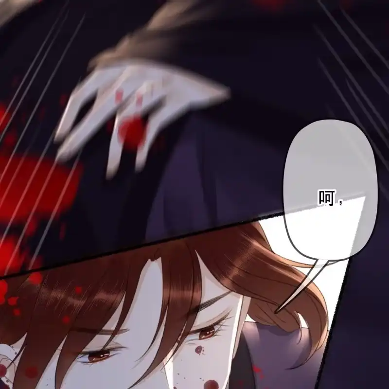《王的宠妃》第174话 养伤 第8页