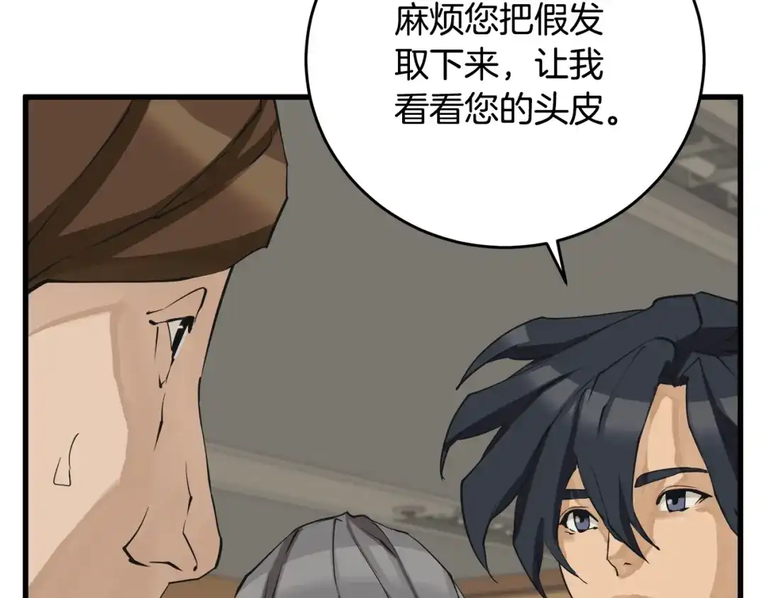 《我的神级笔记本》第139话 治疗脱发 第150页