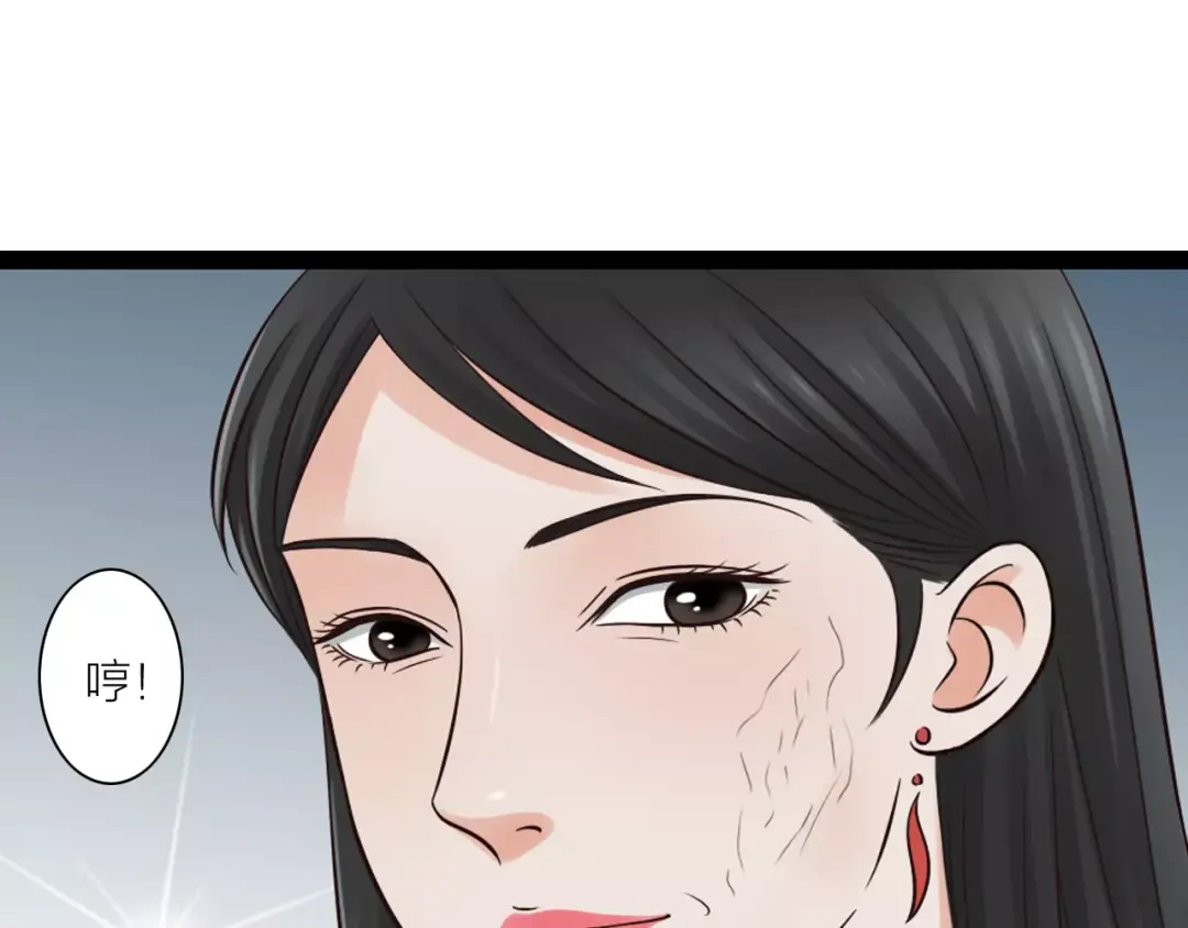 《哑舅》第22话 毁容 第34页