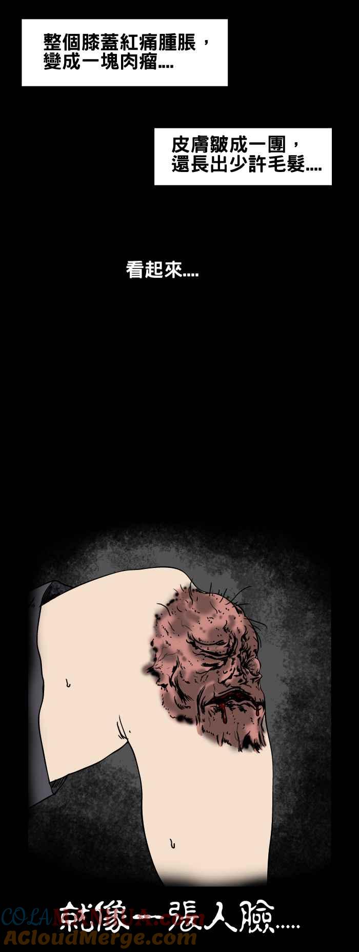 百鬼夜行志・一夜怪谈之卷 - [第63话] 人面疽 - 第5张图