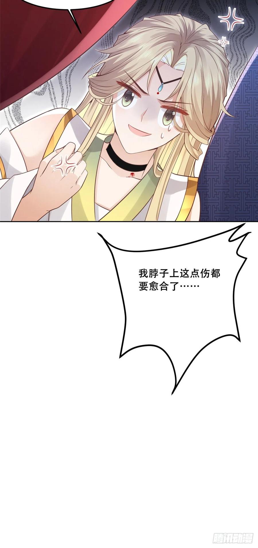 病娇王爷靠我续命 - 56 再不治疗就要愈合啦！ - 第28张图