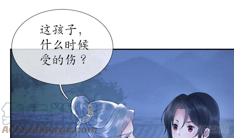 打死也不做师尊 第95话 小尘手腕也有伤 第31页