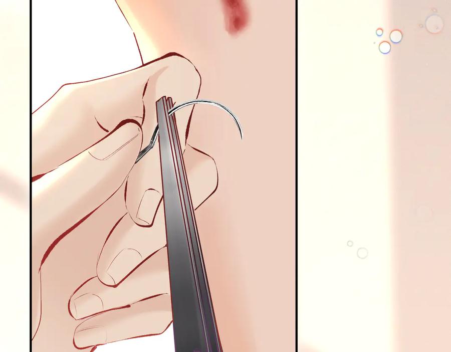 《致命偏宠》第14话 手术 第56页