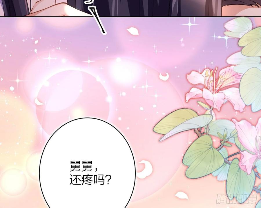 恶女为帝 - 舅舅，还疼吗？ - 第44张图