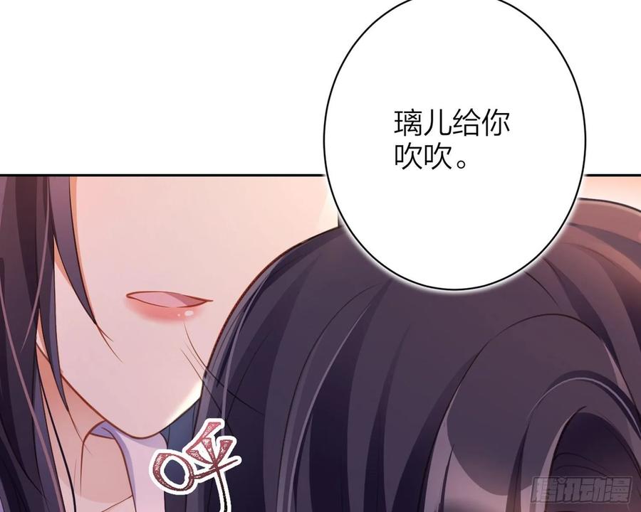 恶女为帝 - 舅舅，还疼吗？ - 第43张图