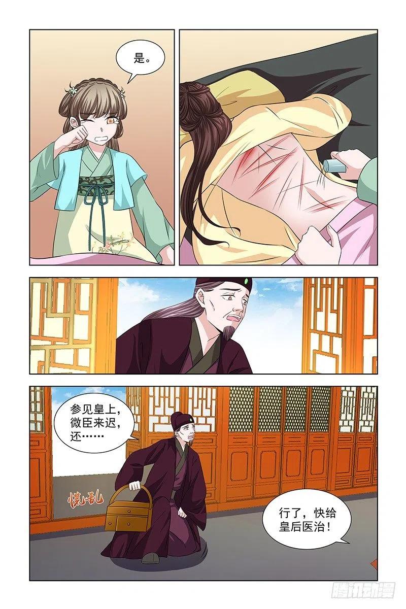 《凤勾情：弃后独步天下》050 快给皇后医治 第3页