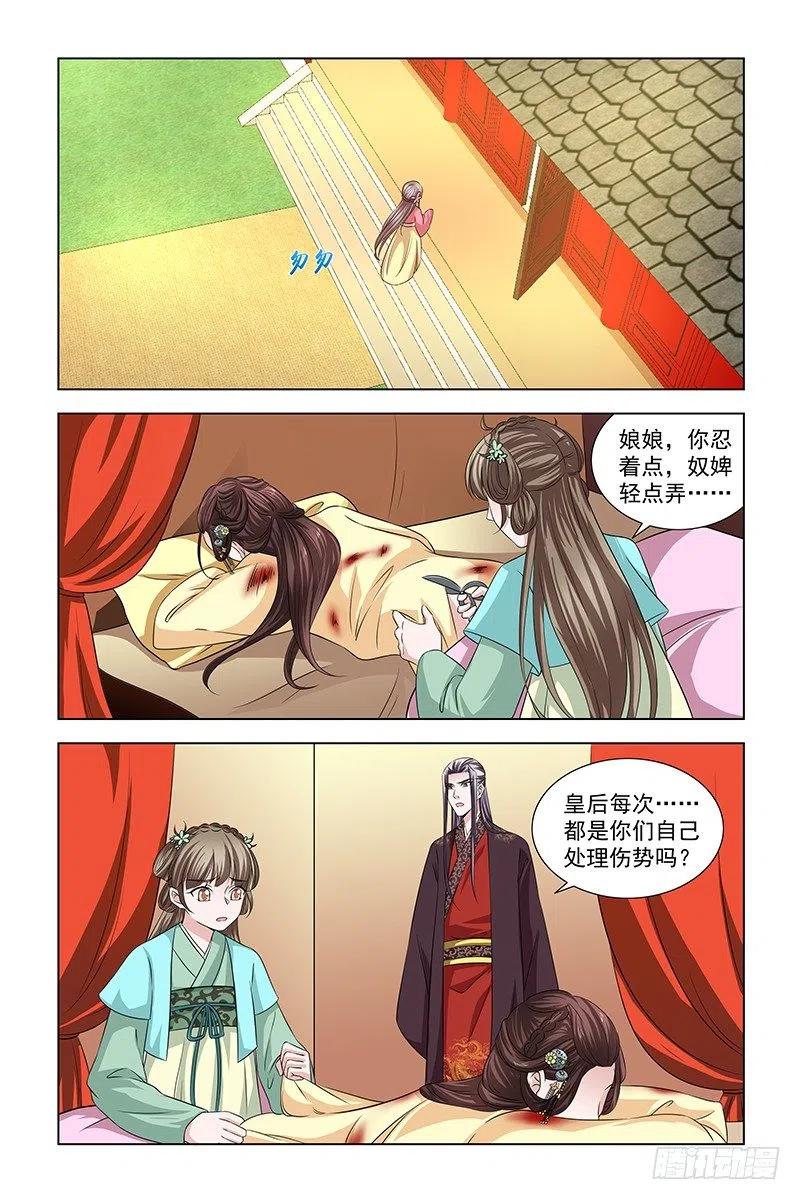 《凤勾情：弃后独步天下》050 快给皇后医治 第2页