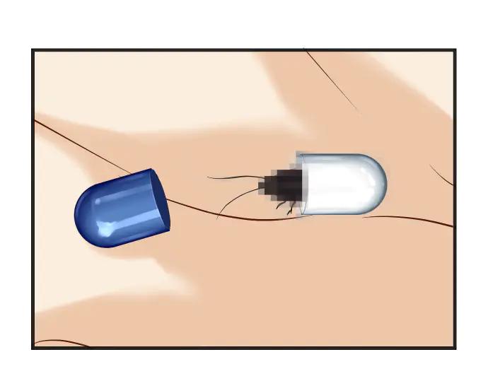 复仇要冷冷端上 - 第275话 Loser - 第74张图