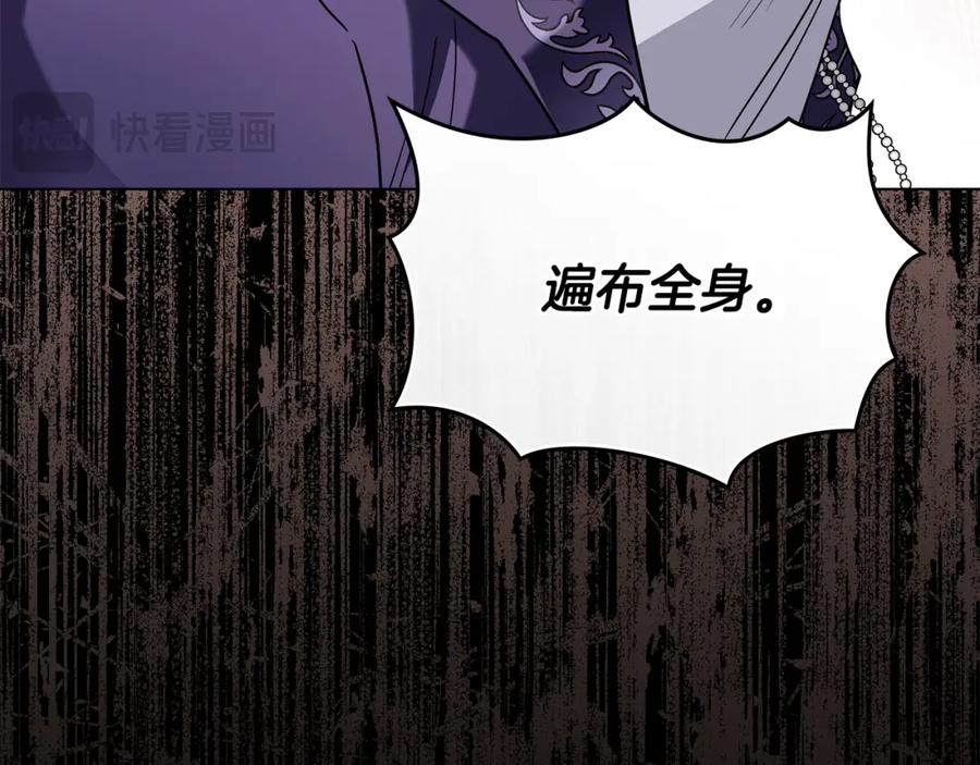 《公爵大人，请别太靠近》第83话 淤青太丑 第19页