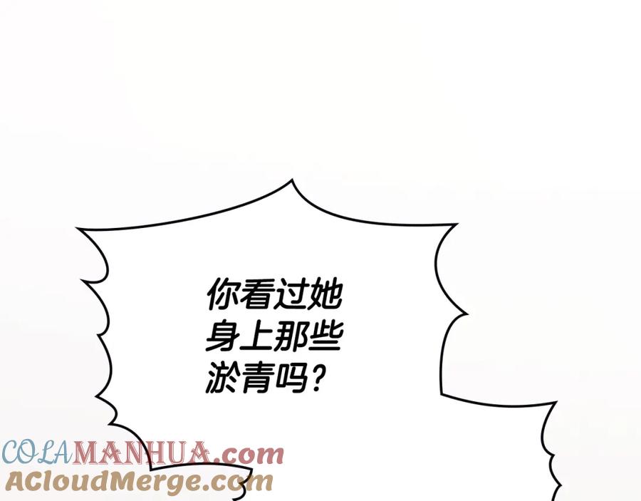 《公爵大人，请别太靠近》第83话 淤青太丑 第13页