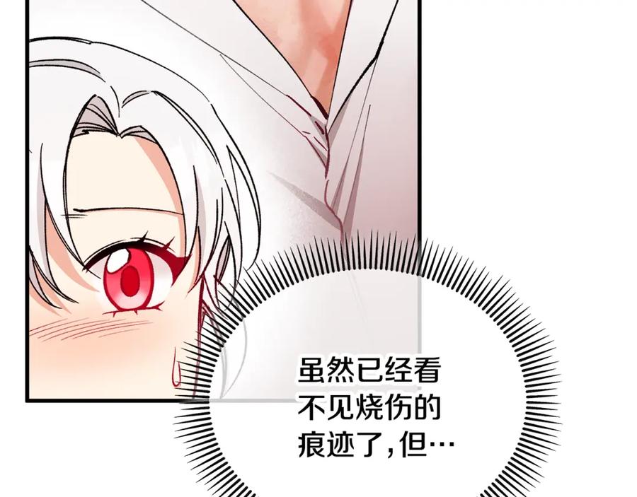 《捡了美男后被他缠上》第34话 泽尔突然烧伤 第32页