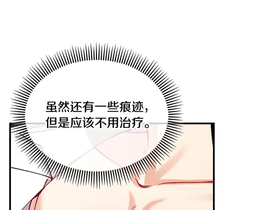 《捡了美男后被他缠上》第34话 泽尔突然烧伤 第54页