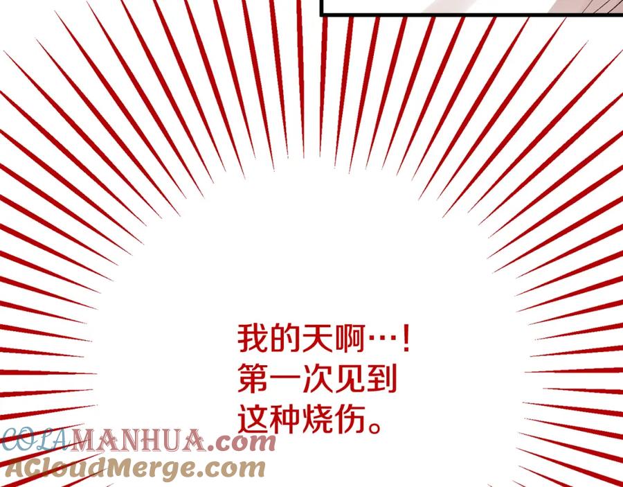 《捡了美男后被他缠上》第34话 泽尔突然烧伤 第5页