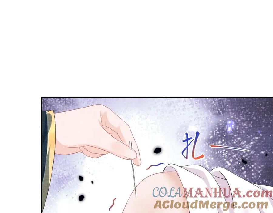 鲛人崽崽三岁啦 第150话 帮二皇子治腿 第69页