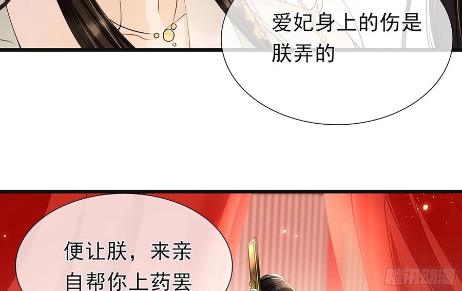 就宴承欢 - 04 专宠开始？ - 第30张图