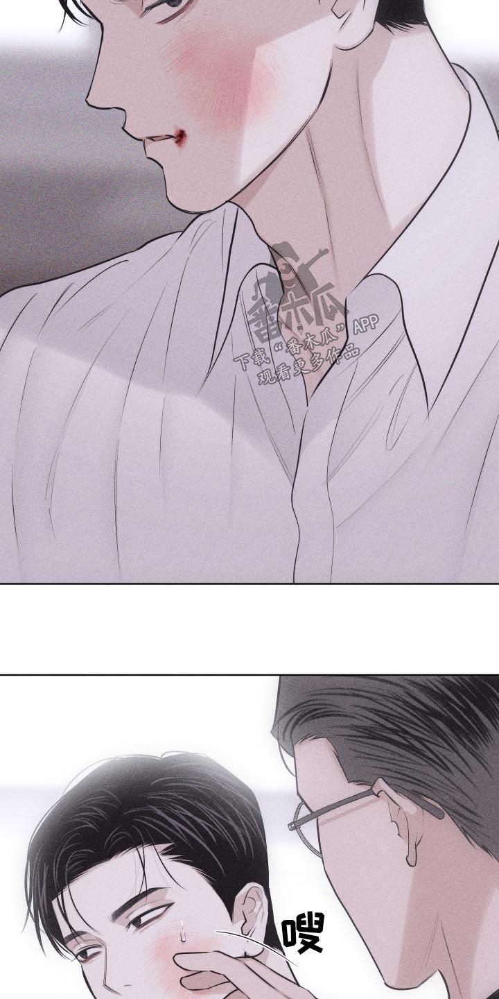 《瓷器》第44章：脸怎么了 第16页