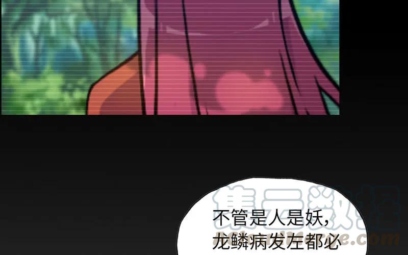 《开局一条鲲》龙鳞病 第81页