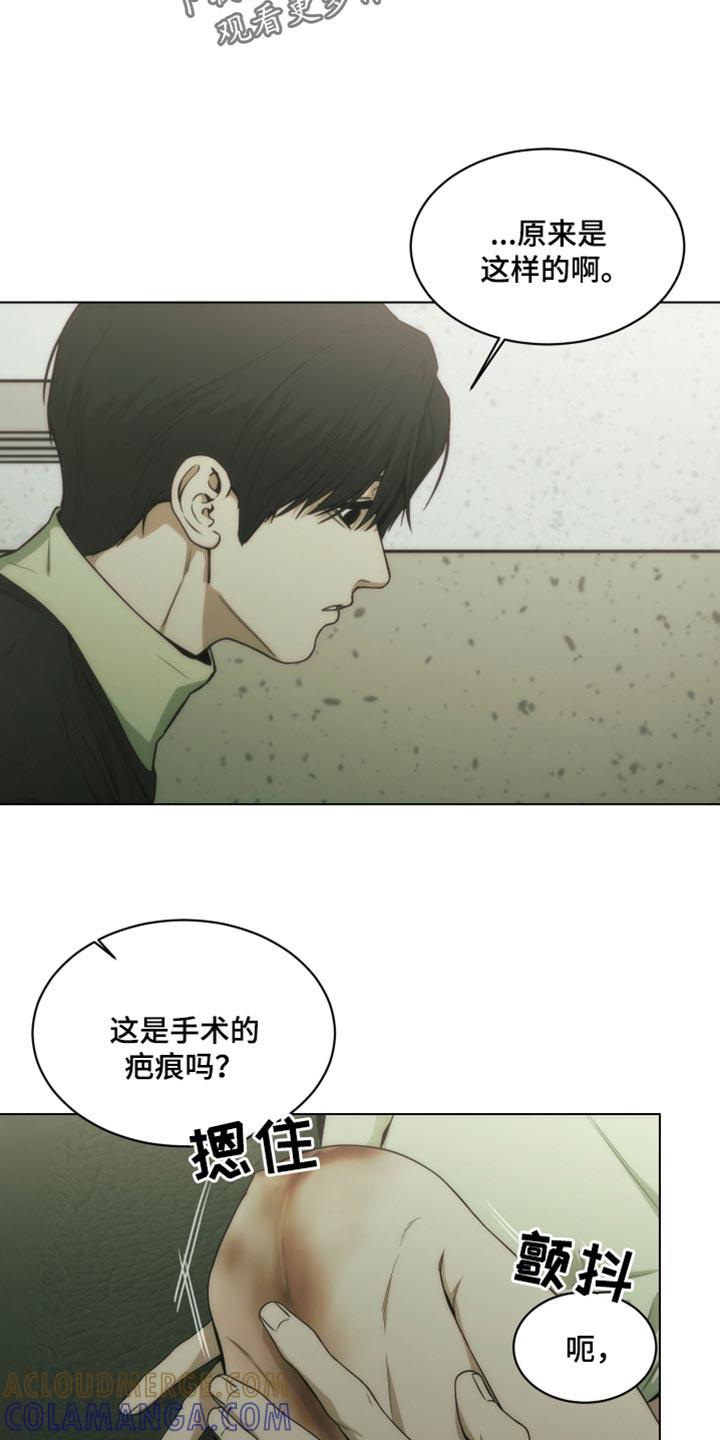《致命诱饵》第42章：手术的疤痕 第3页