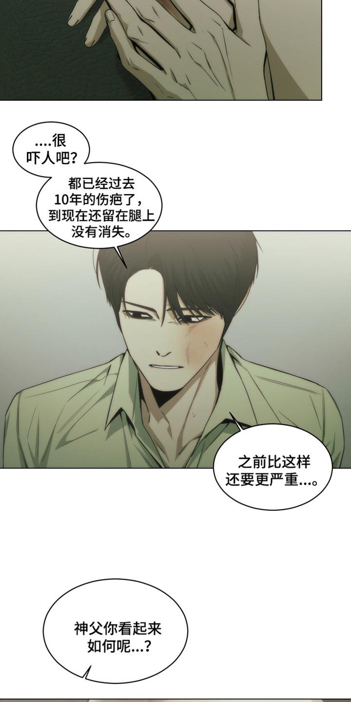 《致命诱饵》第42章：手术的疤痕 第4页