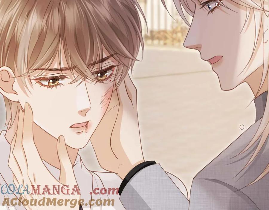 白月光他爱上替身了？！ 第48话 红色胎记 第73页