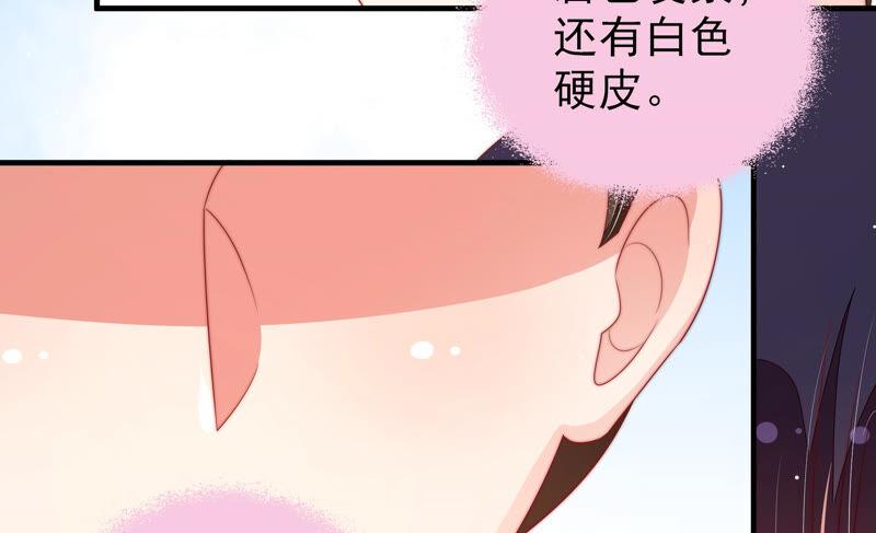 少帅每天都在吃醋 - 第184话 毒已入骨 - 第62张图