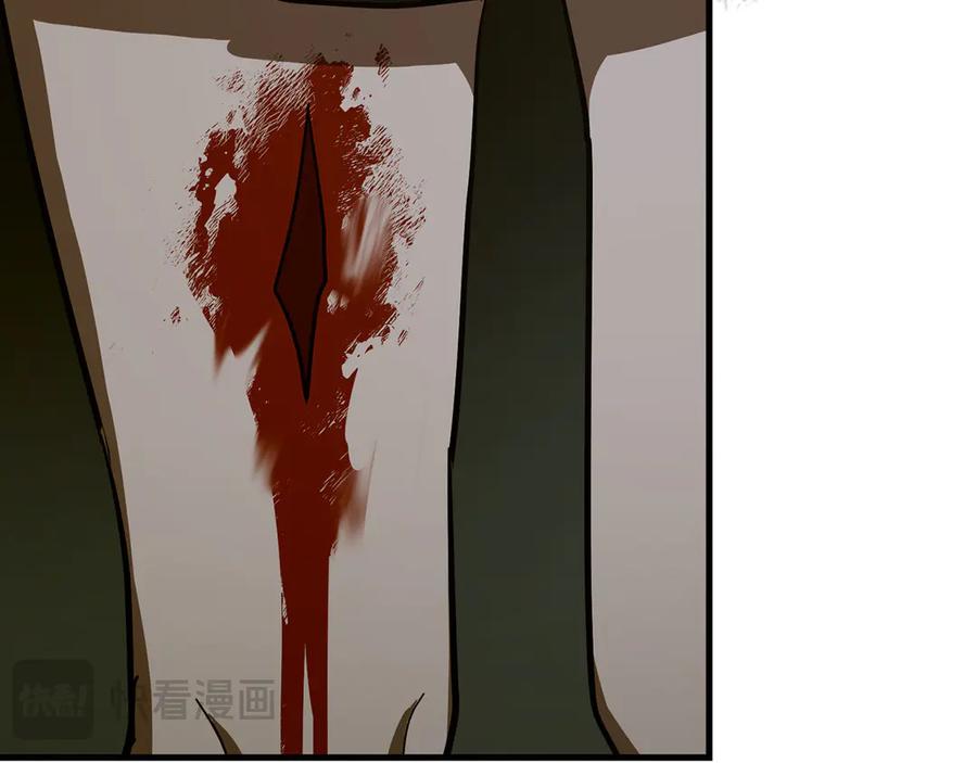 圣子是什么狗屁，这是现代医学的力量 - 第114话 半吸血鬼 - 第103张图