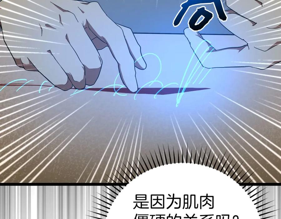 圣子是什么狗屁，这是现代医学的力量 - 第81话 僵人综合征 - 第66张图