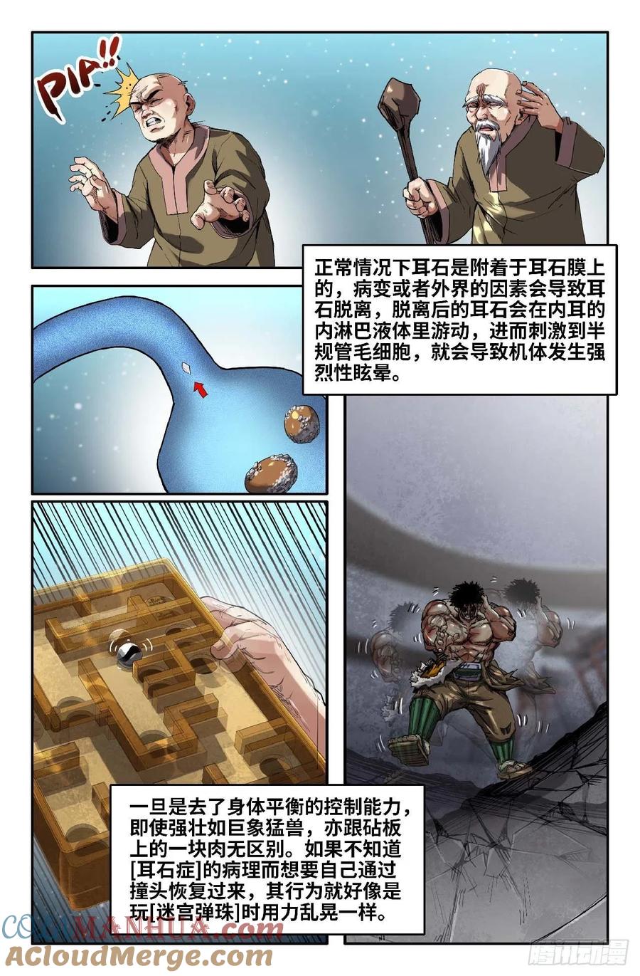 《史上最强》254 耳石症 第3页