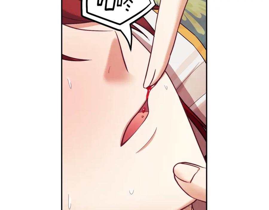 太阳的主人 - 第12话 割手救人 - 第162张图