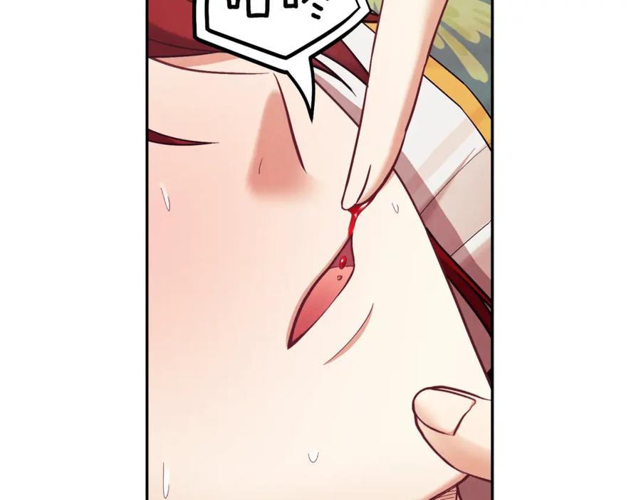 太阳的主人 - 第13话 黑诗瑶能治病 - 第6张图