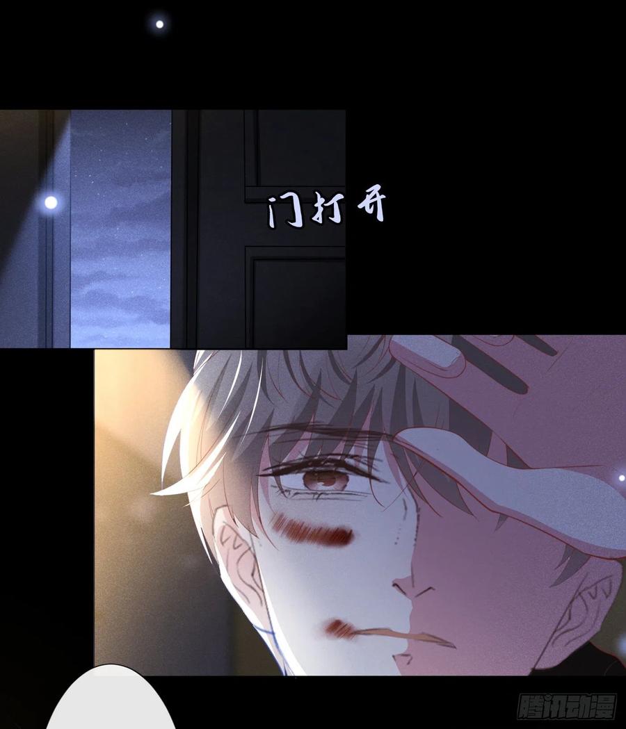 他说我是黑莲花 第73话 痛吗？一定很痛吧 第4页