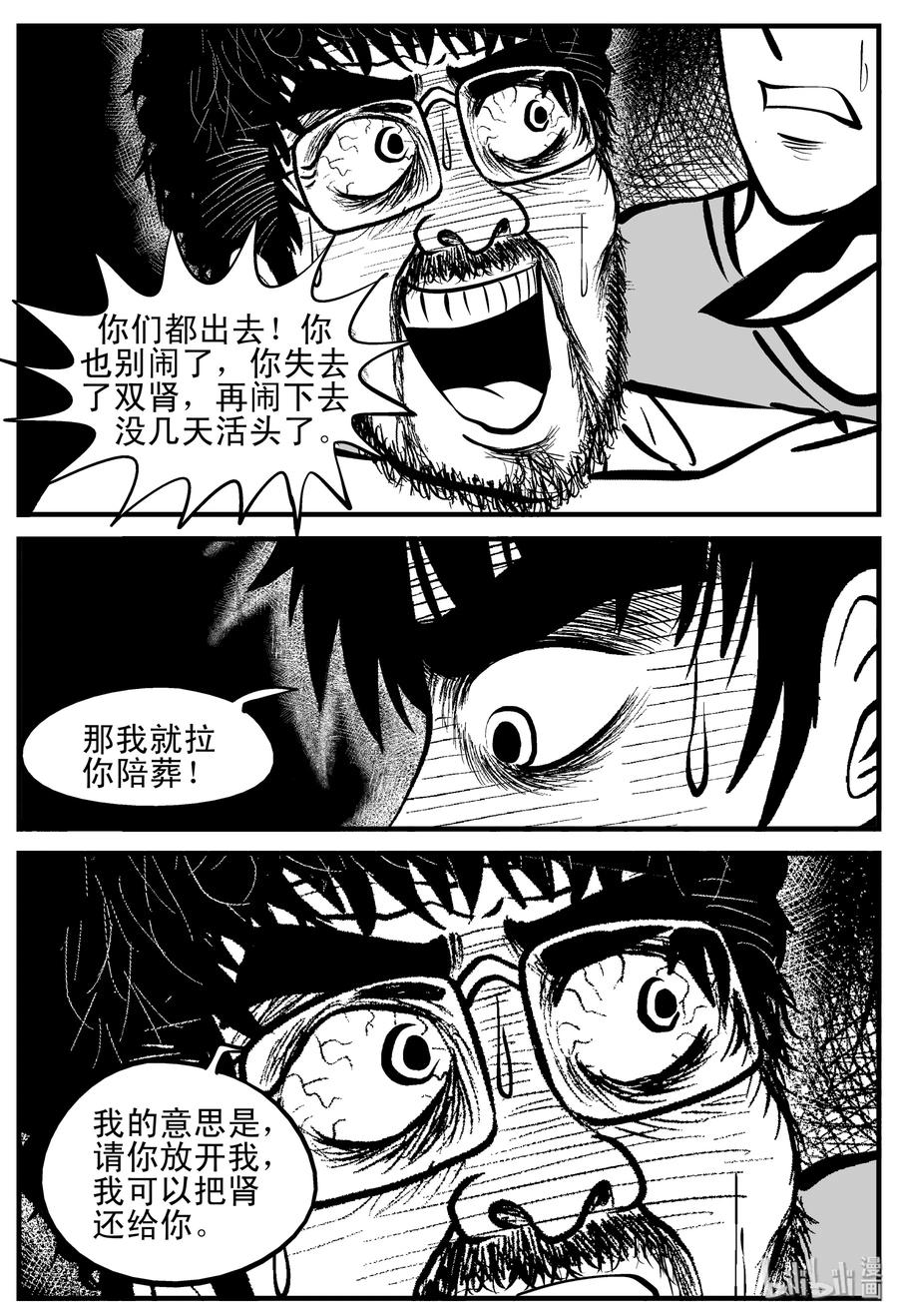 小智怪谈 206 谁偷了我的肾（2） 第8页