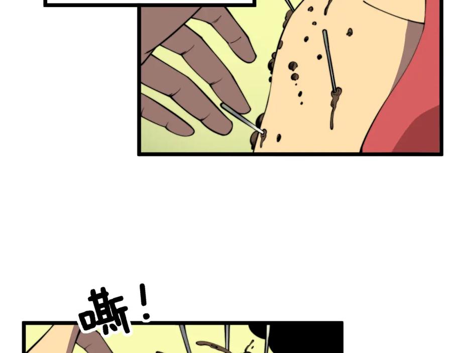 毒手巫医 第338话 弹针法 第36页