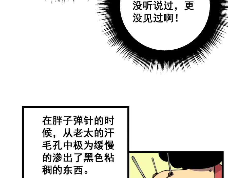 毒手巫医 第338话 弹针法 第35页