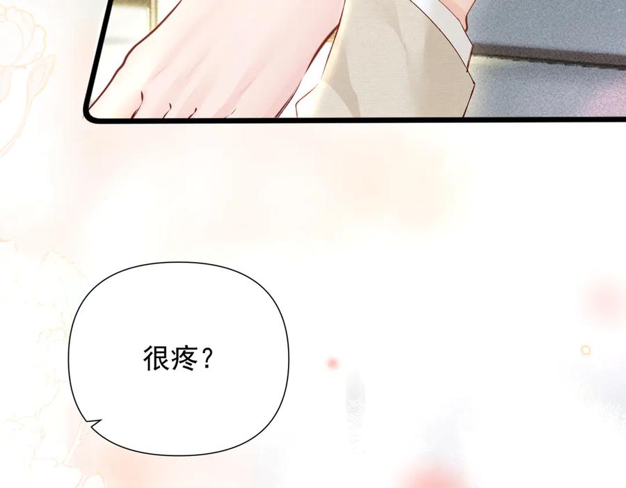 《致命偏宠》第23话 受伤 第80页